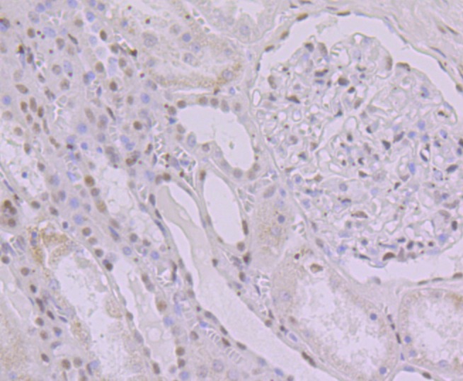 Anti-KHSRP Antibody (6L572)
