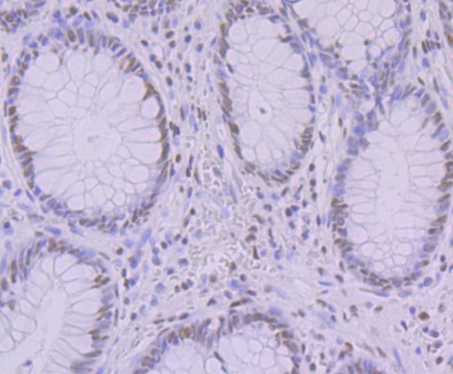 Anti-KHSRP Antibody (6L572)