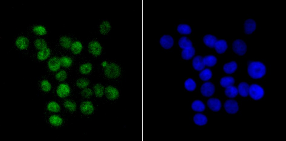 Anti-KHSRP Antibody (6L572)