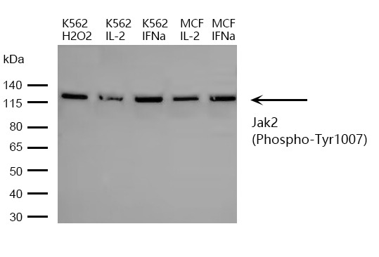 Anti-Phospho-JAK2 (Tyr1007) Polyclonal Antibody