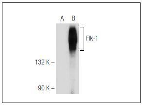 Anti-VEGFR2/KDR Antibody (6F458)