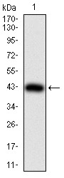Anti-JARID2 Antibody (7C209)