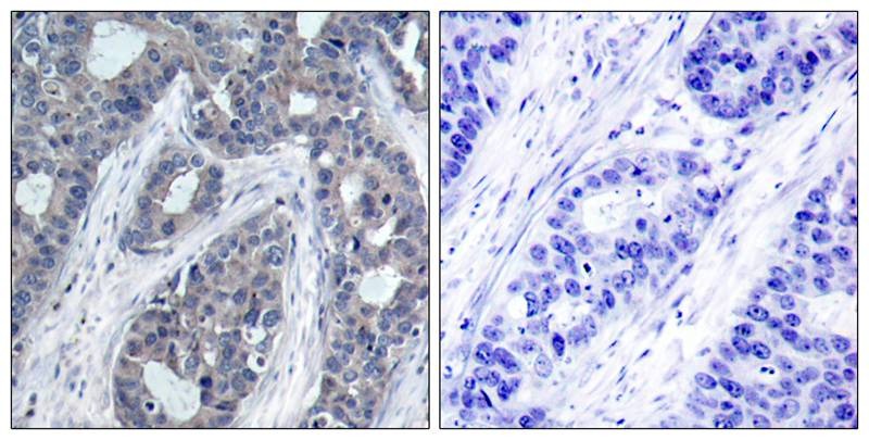 Anti-Phospho-IRS-1 (Ser636) Polyclonal Antibody