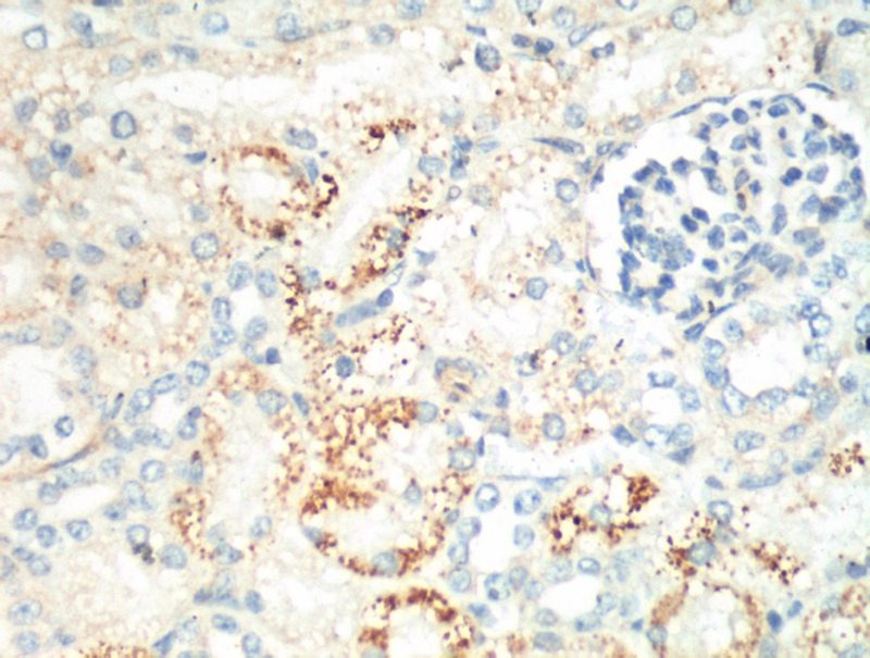 Anti-MKI67 Antibody (3J775)
