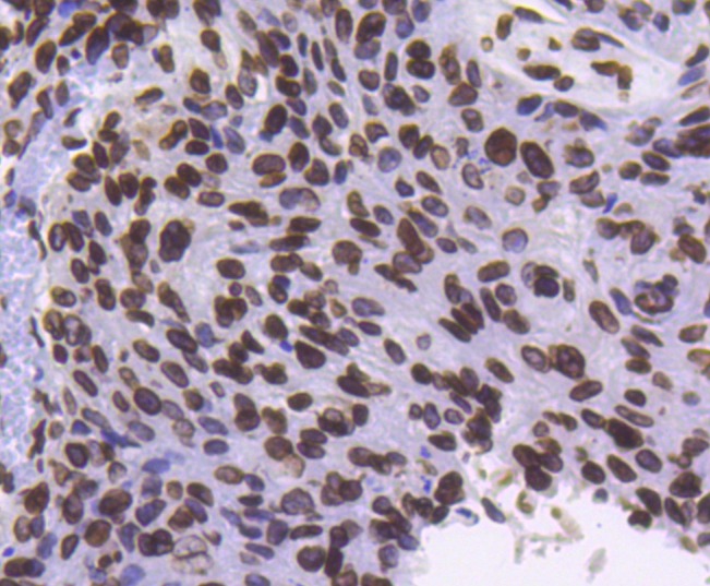 Anti-Lamin B1 Antibody (8Q243)