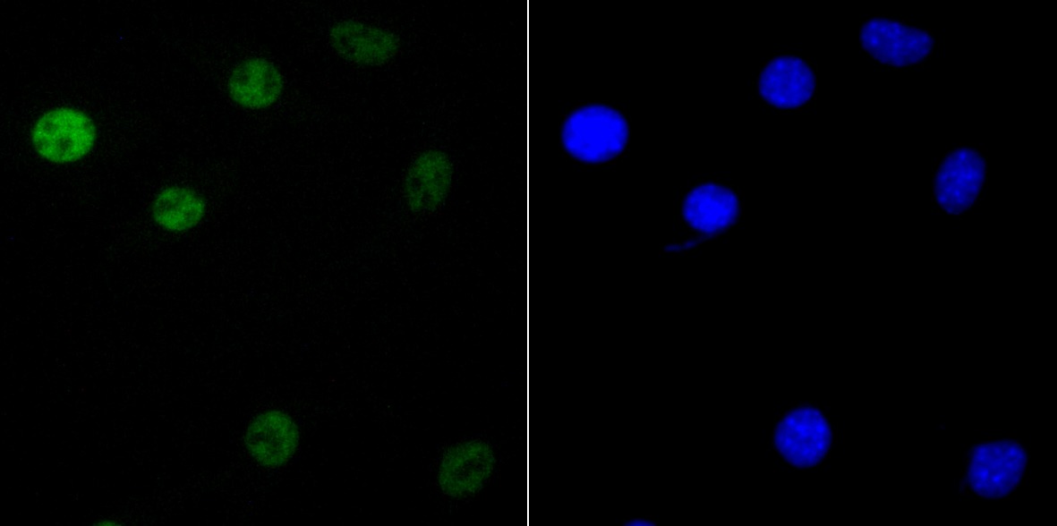 Anti-KHSRP Antibody (6L572)