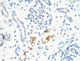 Anti-Kif 7 Antibody (4X104)