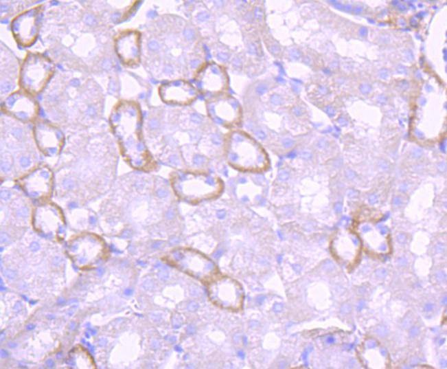 Anti-LAMB1 Antibody (6K439)