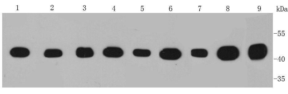 Anti-Isocitrate dehydrogenase/IDH1 Antibody (9Q57)