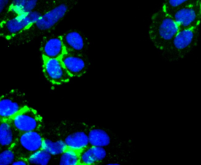 Anti-Laminnin 5 alpha 3 Antibody (7L607)