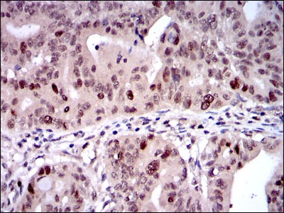 Anti-GJB2 Antibody (8X956)