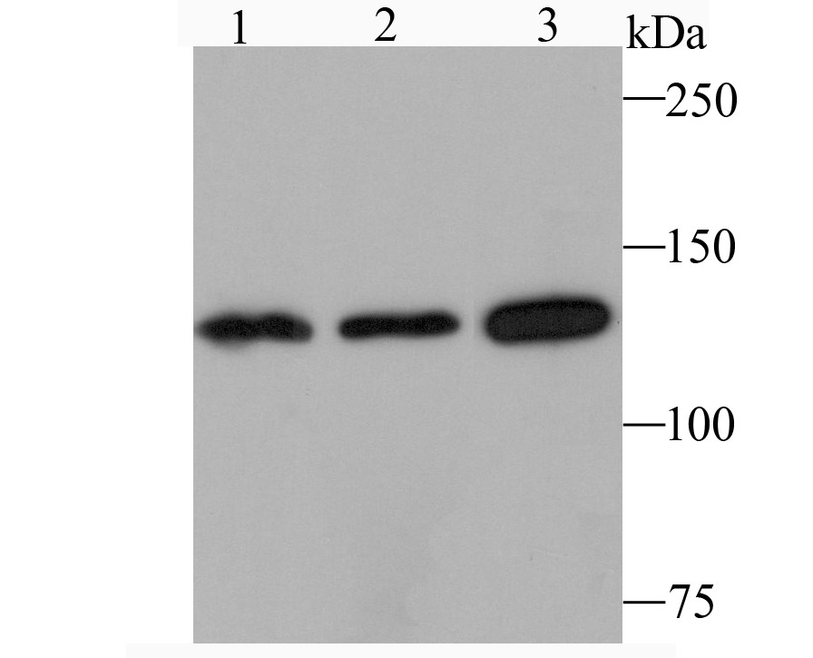 Anti-JAK1 Antibody (4O967)