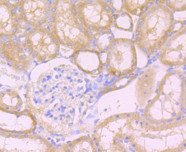 Anti-Niemann Pick C1/NPC1 Antibody (1B891)