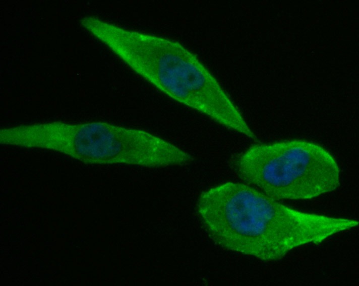 Anti-Niemann Pick C1/NPC1 Antibody (1B891)