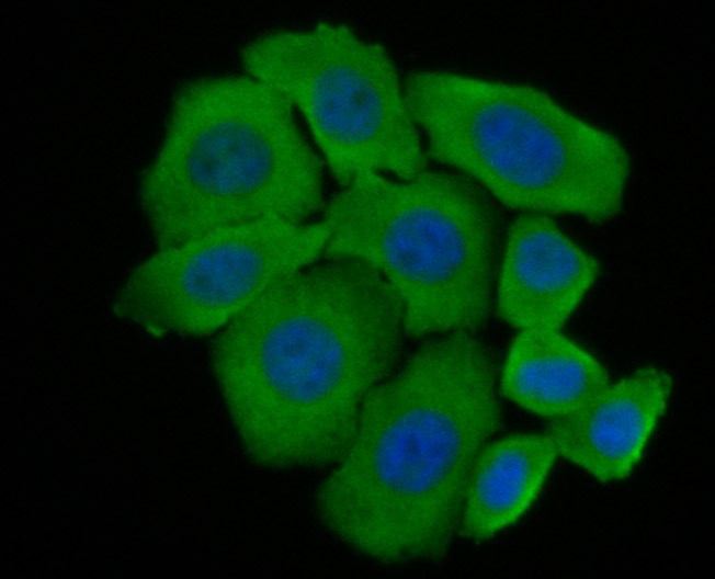 Anti-Niemann Pick C1/NPC1 Antibody (1B891)