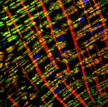 Anti-Myosin Heavy Chain Antibody (1G266)