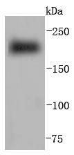 Anti-Myosin-6/MYH6 Antibody (9Q830)