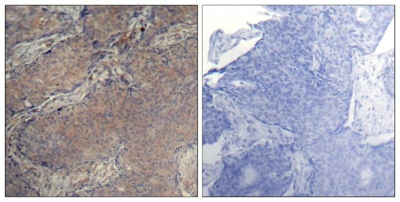 Anti-Phospho-MYL9 (Ser19) Polyclonal Antibody