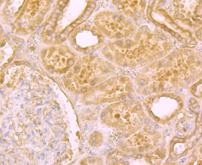 Anti-Niemann Pick C1/NPC1 Antibody (1B891)