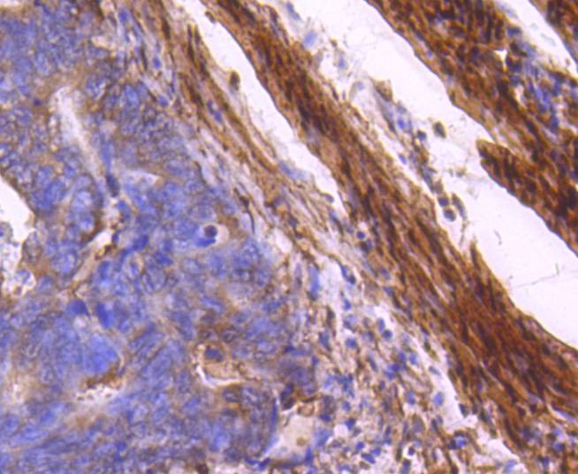 Anti-MYLK Antibody (1W61)