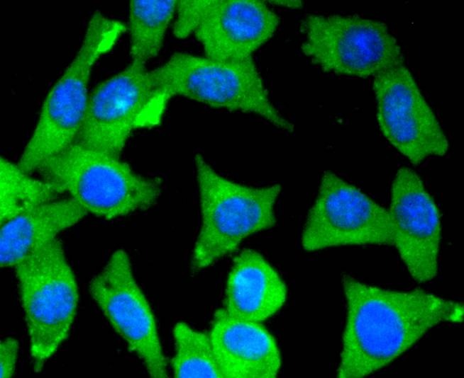 Anti-MYLK Antibody (1W61)