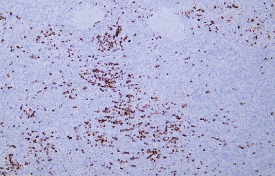 Anti-MPO Antibody (8Z615)