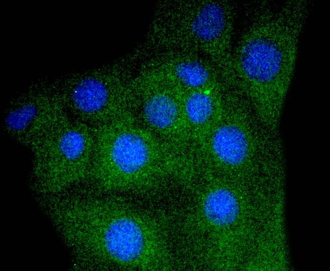 Anti-Myoglobin Antibody (7Y20)