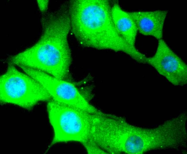 Anti-MYLK Antibody (1W61)