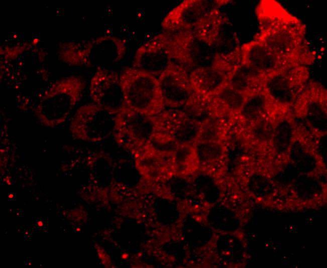 Anti-Phospho-p70 S6 Kinase (Ser 411) Antibody (7V681)