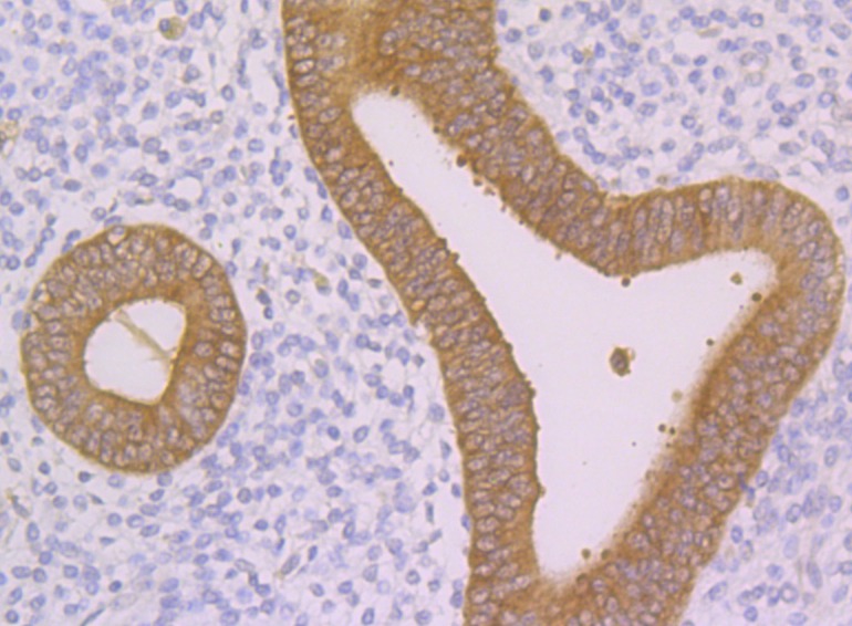 Anti-Nudel Antibody (5F982)