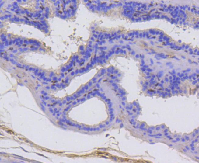 Anti-p63 Antibody (4X27)