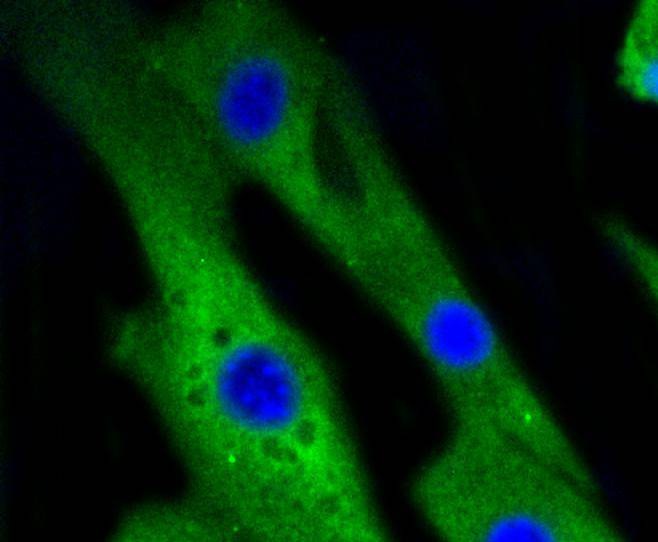 Anti-MAPK14 Antibody (6V701)