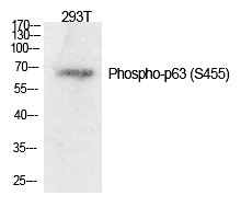 Anti-Phospho-p63 (Ser455) Polyclonal Antibody