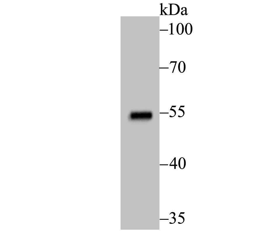 Anti-p53 Antibody (5M213)
