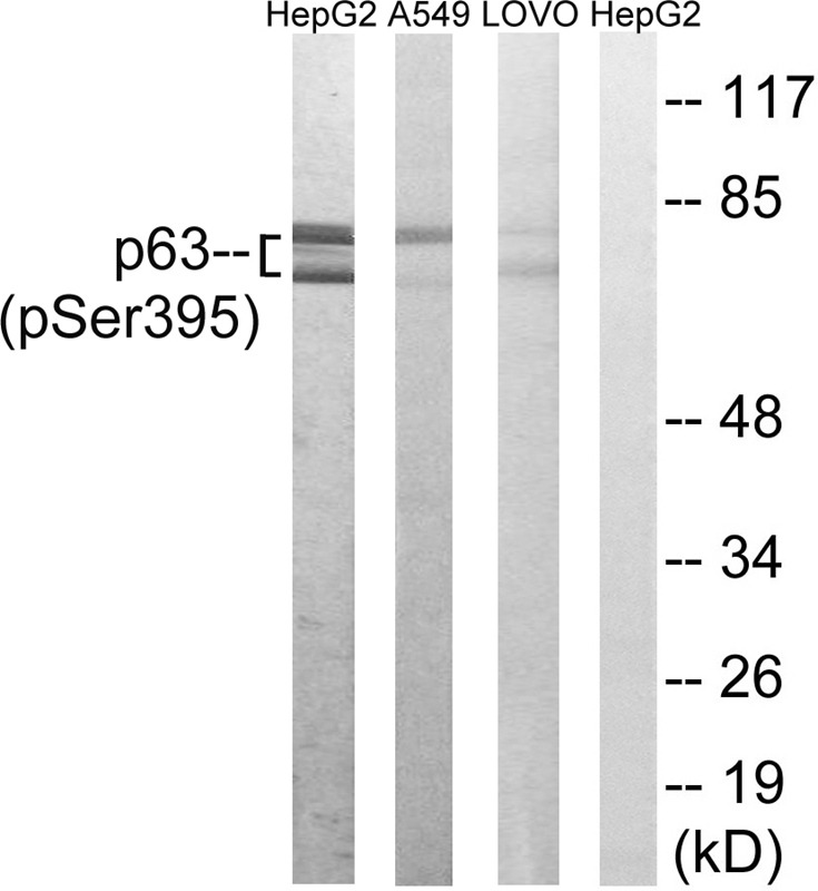 Anti-Phospho-p63 (Ser395) Polyclonal Antibody