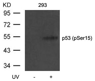 Anti-Phospho-p53 (Ser15) Polyclonal Antibody 2