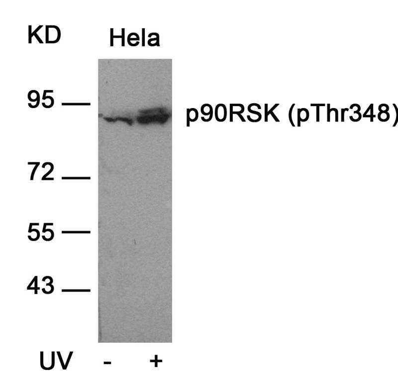 Anti-Phospho-p90RSK (Thr348) Polyclonal Antibody