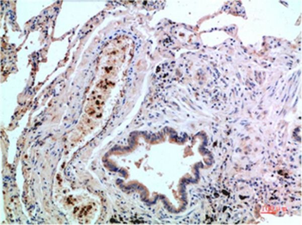 Anti-MAPK14 Antibody (1U459)