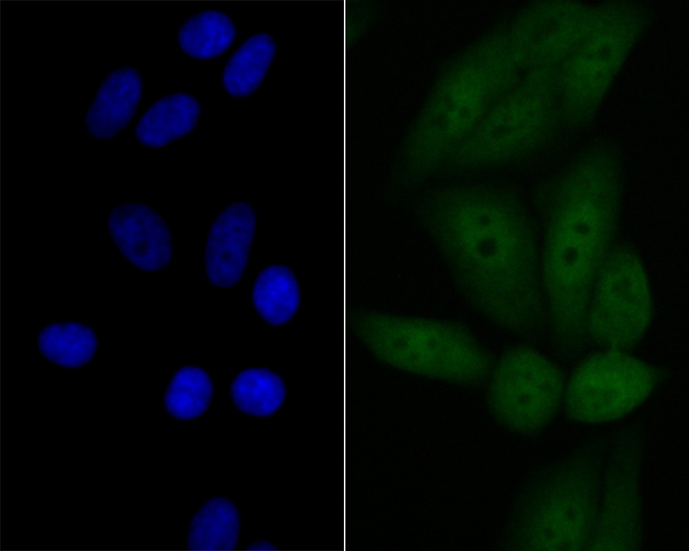 Anti-p53 DINP1 Antibody (7A906)
