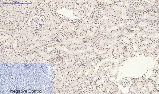 Anti-Phospho-MAPK14 (Tyr323) Polyclonal Antibody