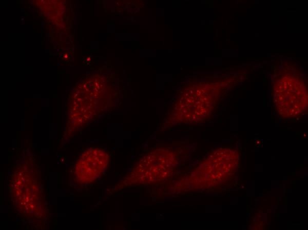 Anti-Phospho-p53 (Ser315) Polyclonal Antibody