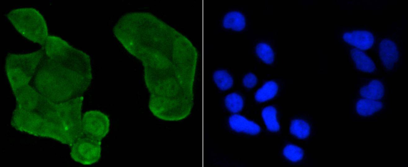 Anti-Acetyl-p53 (Lys370) Antibody (8D75)