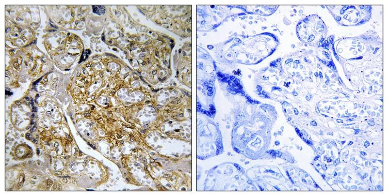 Anti-Phospho-PAK1 (Ser199) Polyclonal Antibody