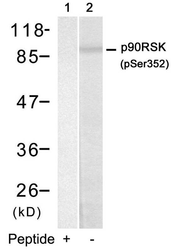 Anti-Phospho-RPS6KA1 (Ser352) Polyclonal Antibody