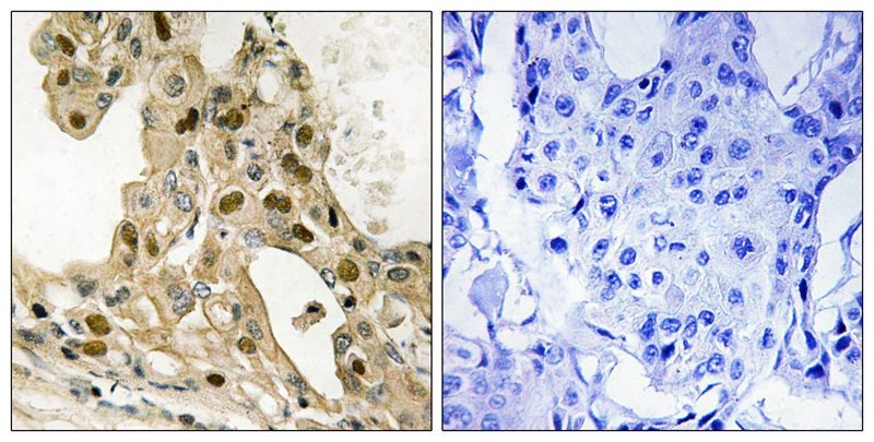 Anti-Phospho-p53 (Thr387) Polyclonal Antibody