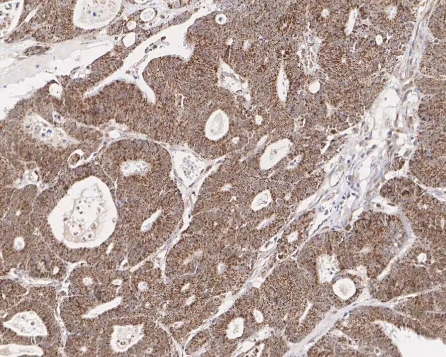 Anti-NR4A1 Antibody (7O127)
