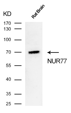 Anti-NR4A1 Antibody (7O127)