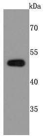 Anti-PABPN1 Antibody (3P321)