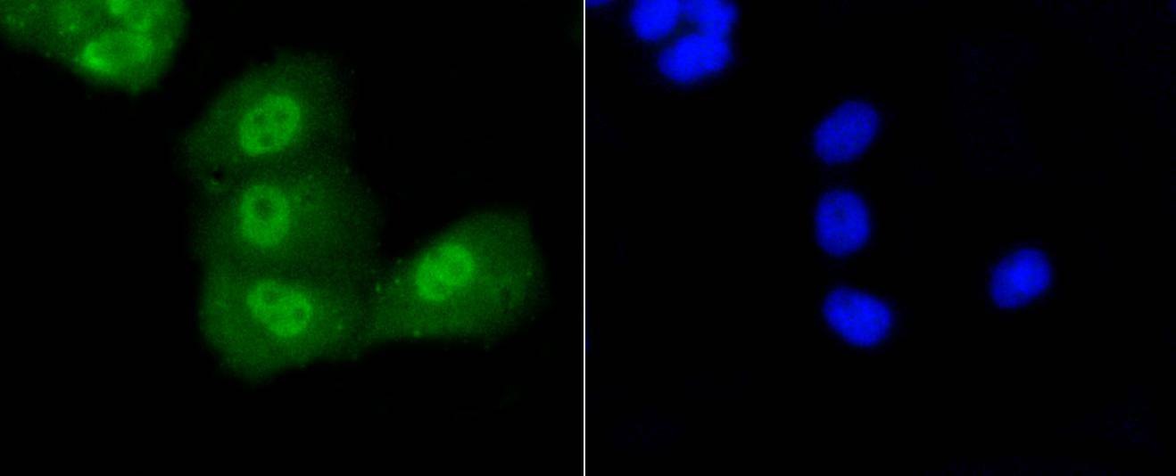Anti-Acetyl-p53 (Lys370) Antibody (8D75)