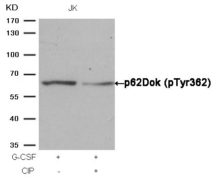 Anti-Phospho-p62Dok (Tyr362) Polyclonal Antibody
